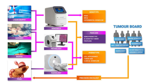 Inzet van AI moet behandelbaarheid van pancreaskanker verbeteren
